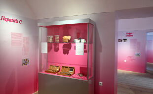 Narrenturm Ausstellung Safe Sex - Foto aus der Ausstellung „Safe Sex. Comeback der Geschlechtskrankheiten“ in der Pathologisch-anatomischen Sammlung in Wien. Zu sehen ist eine Ausstellungsvitrine mit verschiedenen Untersuchungsgegenständen aus der Gynäkologie. - © Foto: Chloe Potter