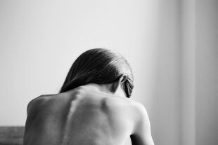 Anorexie - © Foto: iStock/KatarzynaBialasiewicz